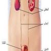 تعرف على أنواع السلس البولى وأعراضه