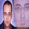 توجد هالات سوداء تحت عينى.. فما الحل؟