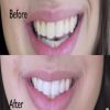 متى يكون تجميل الأسنان ضرورة