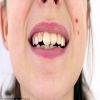 المبالغة فى تنظيف الأسنان قد تسبب مخاطر صحية