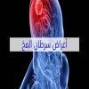 اعراض سرطان المخ