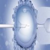 دراسة إيطالية: الحقن المجهرى يزيد خطر الولادة المبكرة