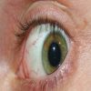 مستحضرات التجميل تسبب جفاف العين فى الشتاء