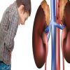 علاج الفشل الكلوى بطرق طبيعية ودوائية