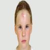 نصائح لعلاج الكيس الدهنى منها النظافة المستمرة