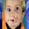 طفلة مصرية بفمين