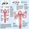 اكتشفي أسباب ومخاطر الحمل خارج الرحم