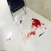 طعن طالبة في جامعة الجوف
