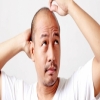 للصلع.. فوائد خفية قد تعرفها لأول مرة!!
