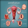 5 أسباب لآلام المهبل