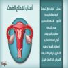 دليلك للتعامل مع المشاكل الطبية الشائعة للدورة الشهرية