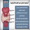 الغدة الدرقية..لماذا تختل وكيف يتم علاجها؟