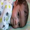 أعراض فقر الدم عند الأطفال