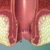 الحمام الدافئ والكمادات الباردة يخففان آلام البواسير عند الأطفال